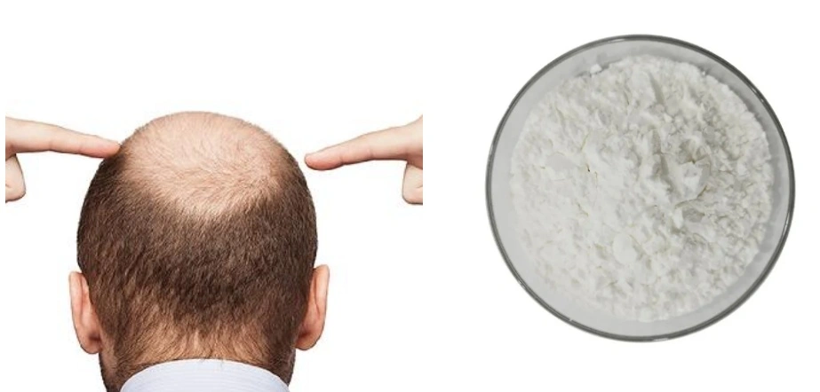 Minoxidil Powder Minoxidil Powder